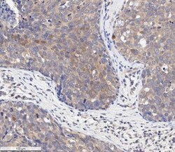AKT1, p Ser473 Antibody (104A282) - BSA Free, Novus Biologicals:Antibodies:Primary